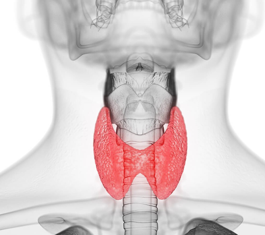 متلازمة بندرد